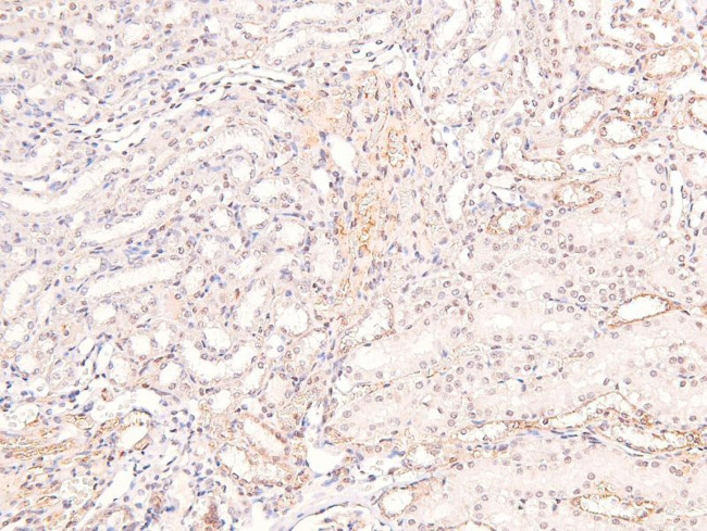 Phospho-DRP1 (Tyr504) Antibody in Immunohistochemistry (Paraffin) (IHC (P))