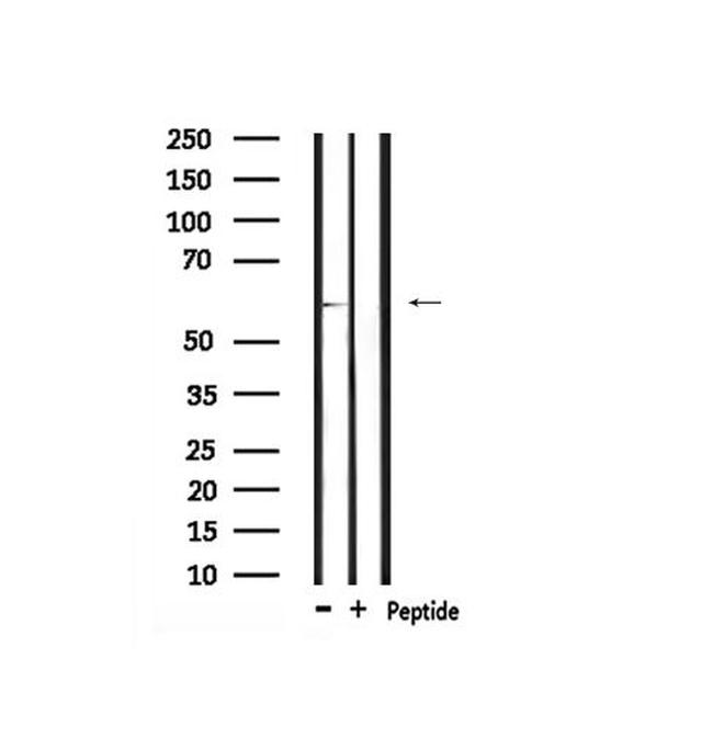 Phospho-DRP1 (Tyr504) Antibody in Western Blot (WB)