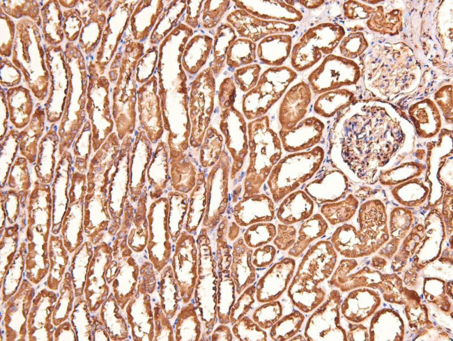 Phospho-CtBP1/CtBP2 (Ser158, Ser164) Antibody in Immunohistochemistry (Paraffin) (IHC (P))