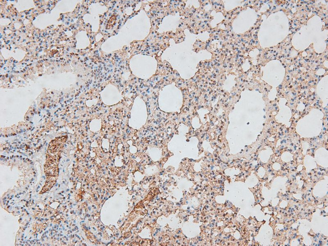 Phospho-CtBP1/CtBP2 (Ser158, Ser164) Antibody in Immunohistochemistry (Paraffin) (IHC (P))