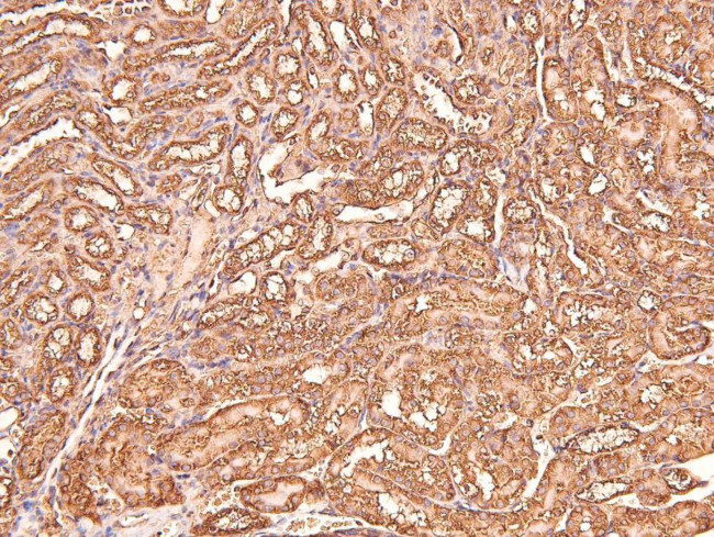 Phospho-CtBP1/CtBP2 (Ser158, Ser164) Antibody in Immunohistochemistry (Paraffin) (IHC (P))