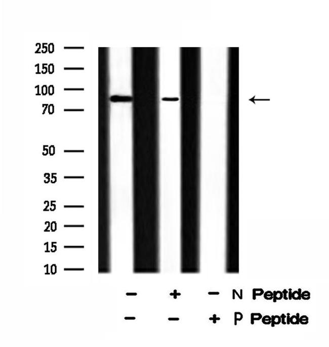 Phospho-EEF2K (Ser359) Antibody in Western Blot (WB)