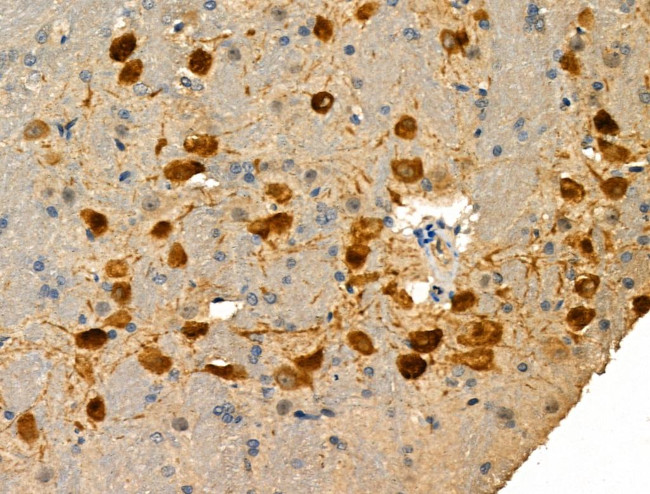 Phospho-FOXO1 (Ser249) Antibody in Immunohistochemistry (Paraffin) (IHC (P))