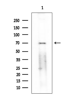 Phospho-FOXO1 (Ser249) Antibody in Western Blot (WB)