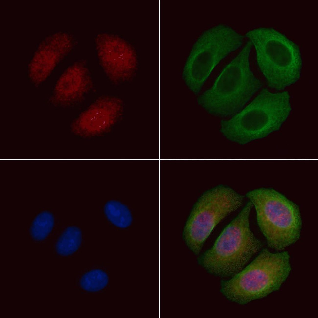 Phospho-FOXO1 (Ser249) Antibody in Immunocytochemistry (ICC/IF)