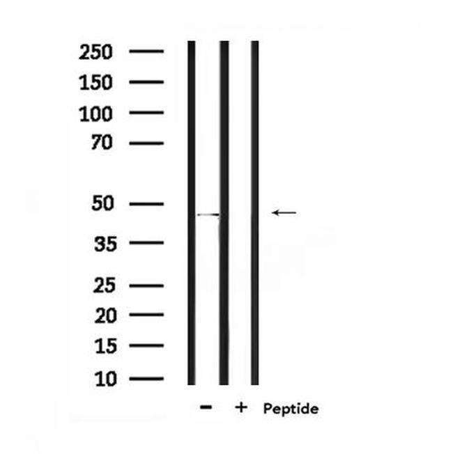 Phospho-MAZ (Thr72) Antibody in Western Blot (WB)