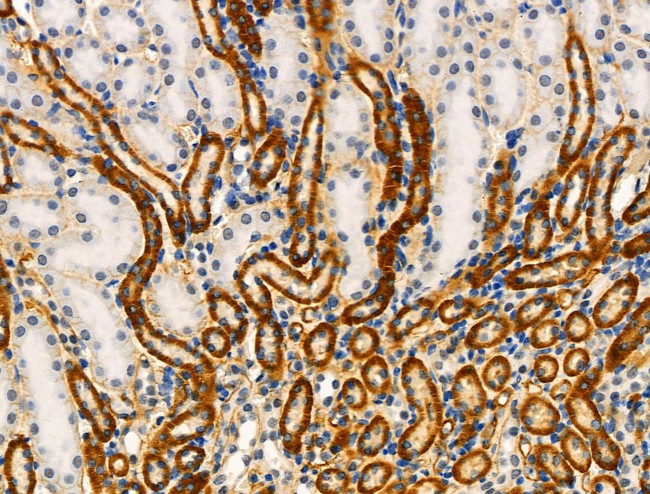 Phospho-MKP3 (Ser197) Antibody in Immunohistochemistry (Paraffin) (IHC (P))