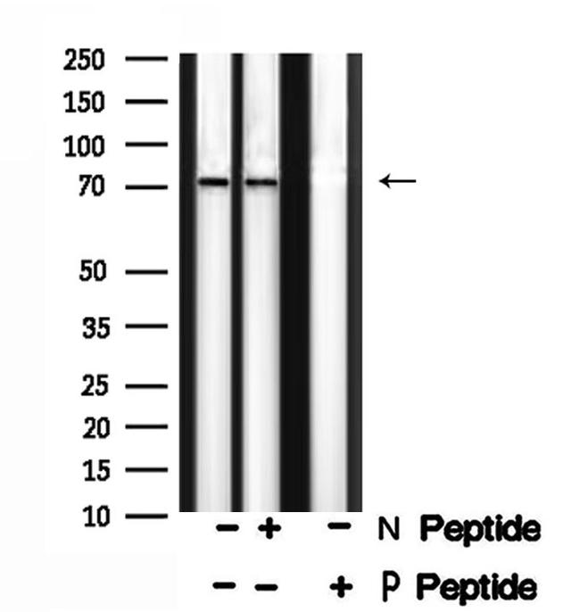 Phospho-DUSP16 (Ser446) Antibody in Western Blot (WB)