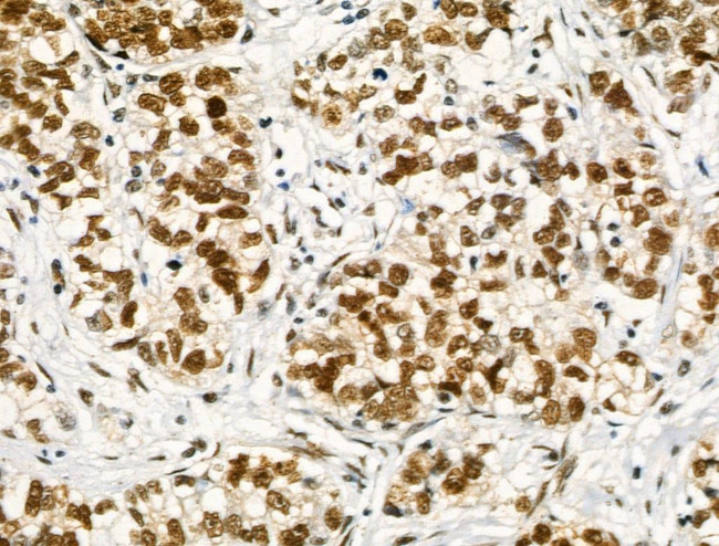 Phospho-NFATC1 (Ser172) Antibody in Immunohistochemistry (Paraffin) (IHC (P))