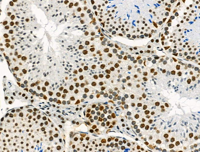 Phospho-NFATC1 (Ser172) Antibody in Immunohistochemistry (Paraffin) (IHC (P))