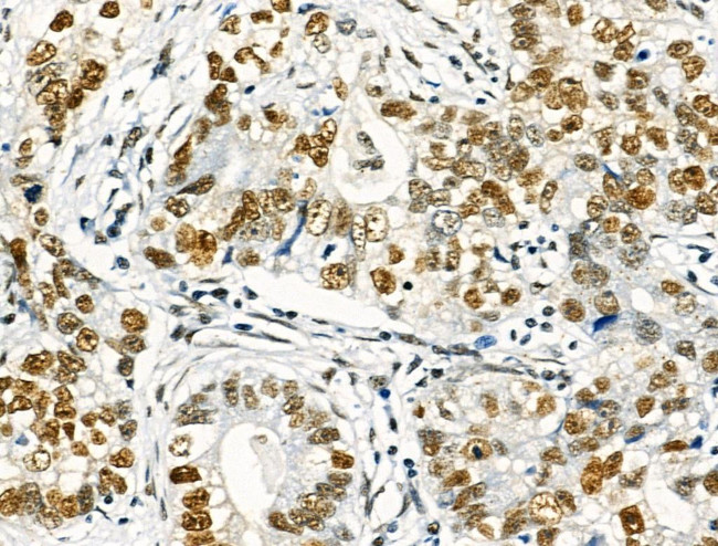 Phospho-NFATC1 (Ser172) Antibody in Immunohistochemistry (Paraffin) (IHC (P))