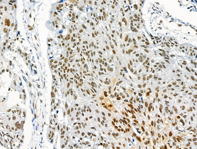 Phospho-NFATC1 (Ser172) Antibody in Immunohistochemistry (Paraffin) (IHC (P))