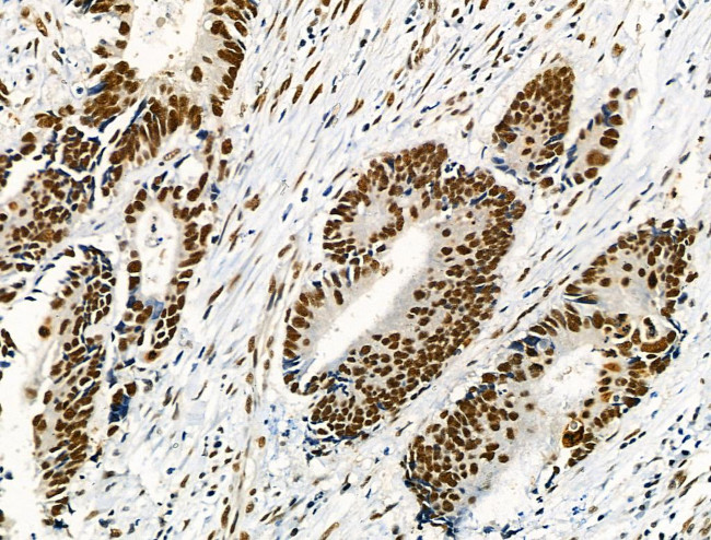 Phospho-NFATC1 (Ser172) Antibody in Immunohistochemistry (Paraffin) (IHC (P))