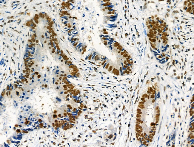 Phospho-NFATC1 (Ser172) Antibody in Immunohistochemistry (Paraffin) (IHC (P))