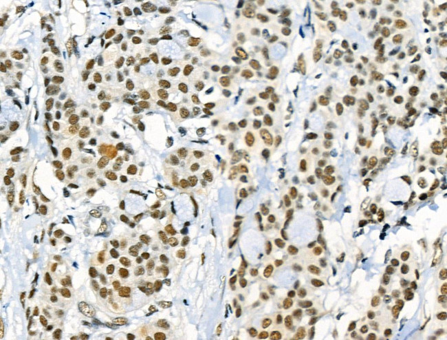 Phospho-NFATC1 (Ser172) Antibody in Immunohistochemistry (Paraffin) (IHC (P))