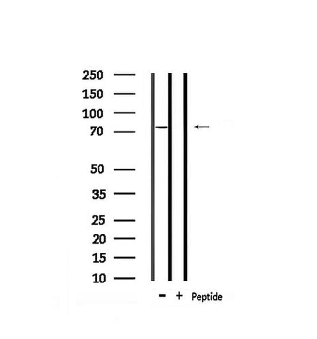 Phospho-PAK6 (Ser165) Antibody in Western Blot (WB)