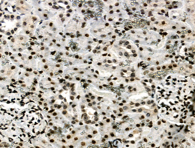 Phospho-RAD17 (Ser646) Antibody in Immunohistochemistry (Paraffin) (IHC (P))