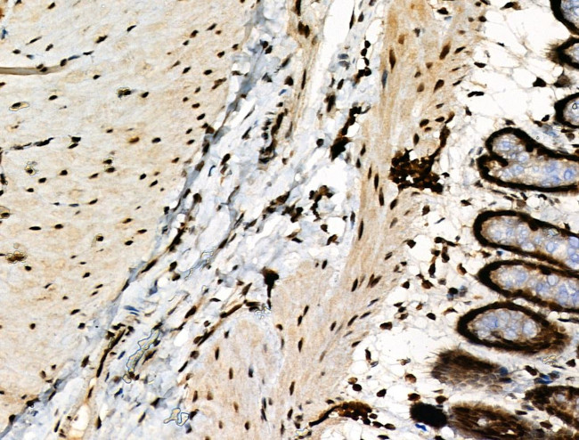 Phospho-RAD17 (Ser646) Antibody in Immunohistochemistry (Paraffin) (IHC (P))