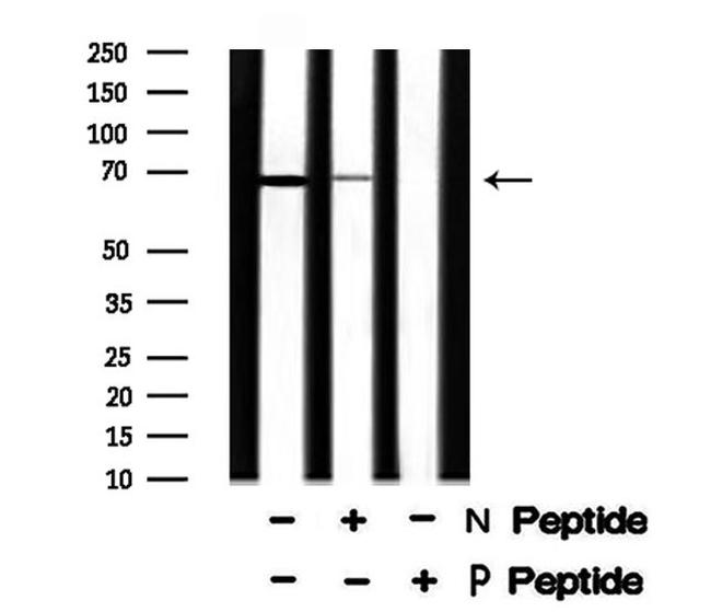 Phospho-SHC3 (Tyr424) Antibody in Western Blot (WB)