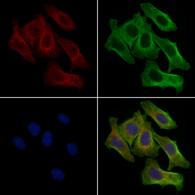 Phospho-SHC3 (Tyr424) Antibody in Immunocytochemistry (ICC/IF)