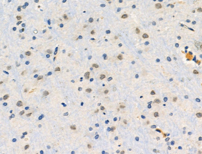 Phospho-SHC3 (Tyr424) Antibody in Immunohistochemistry (Paraffin) (IHC (P))