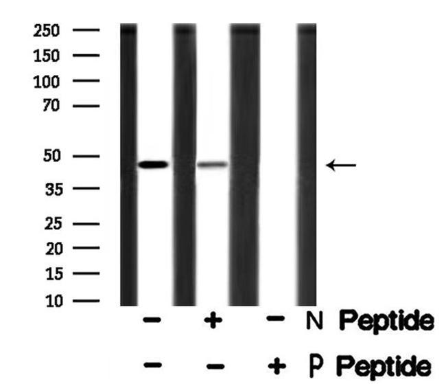 Phospho-SPHK1 (Ser225) Antibody in Western Blot (WB)