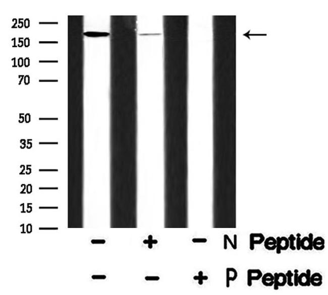 Phospho-SRC1 (Thr1179) Antibody in Western Blot (WB)