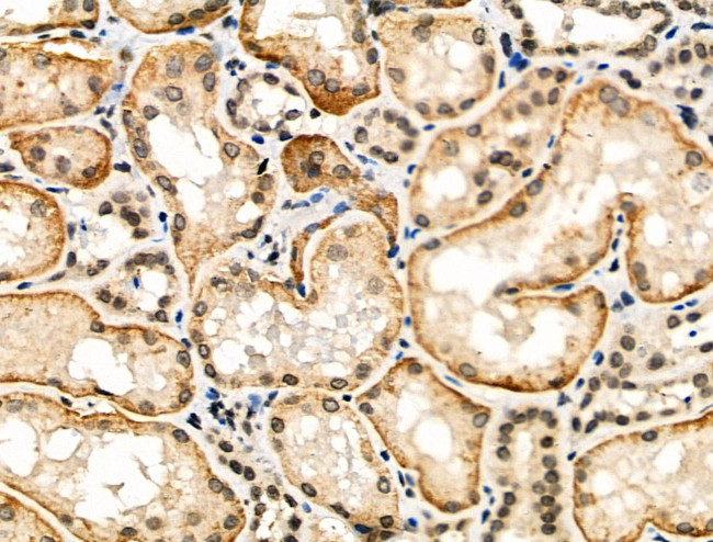 Phospho-SREBP2 (Ser455) Antibody in Immunohistochemistry (Paraffin) (IHC (P))