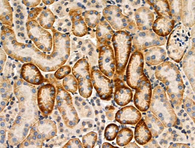 Phospho-SREBP2 (Ser455) Antibody in Immunohistochemistry (Paraffin) (IHC (P))