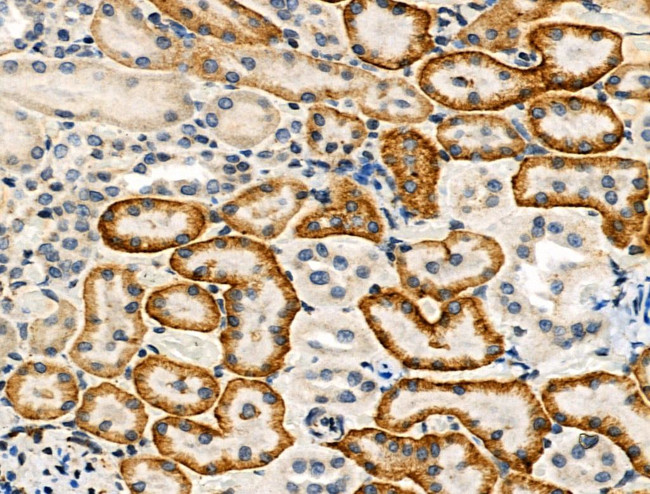 Phospho-SREBP2 (Ser455) Antibody in Immunohistochemistry (Paraffin) (IHC (P))