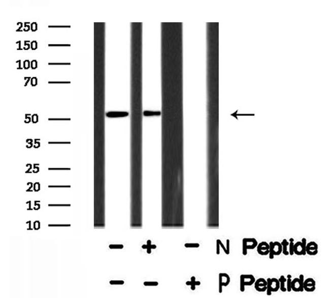Phospho-NR5A1 (Ser203) Antibody in Western Blot (WB)