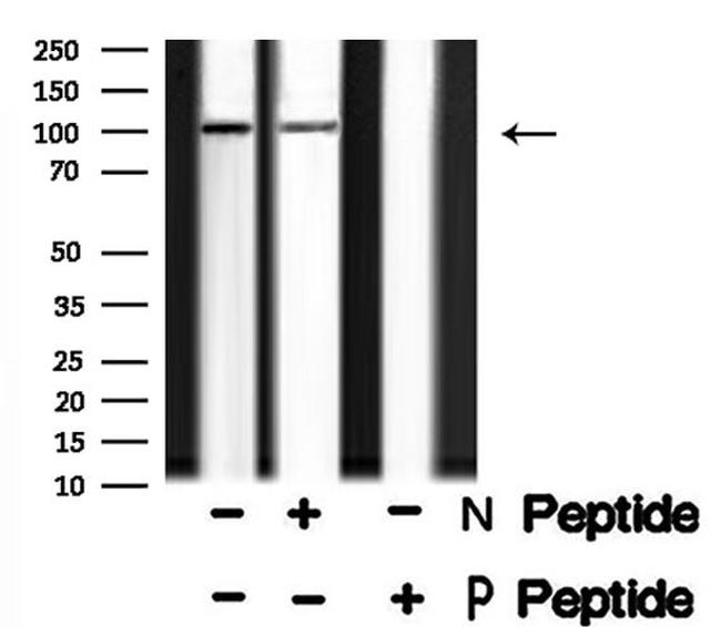 Phospho-TLR3 (Tyr759) Antibody in Western Blot (WB)