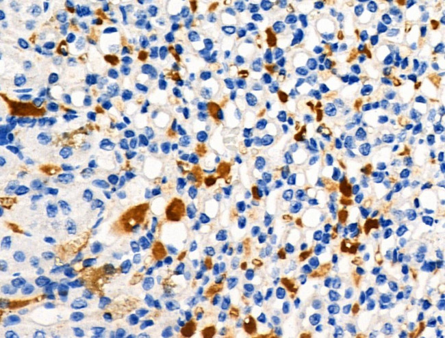 Phospho-TLR5 (Tyr798) Antibody in Immunohistochemistry (Paraffin) (IHC (P))