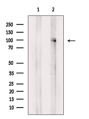 Phospho-TLR5 (Tyr798) Antibody in Western Blot (WB)