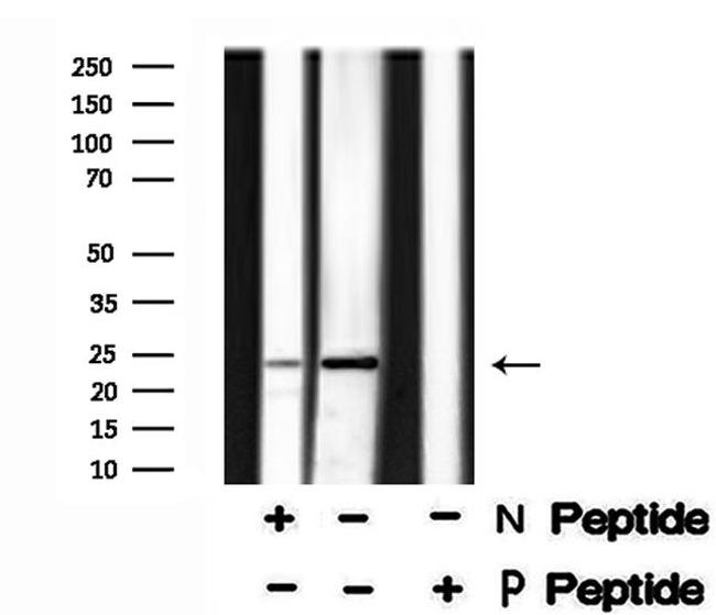 Phospho-TPPP (Ser18) Antibody in Western Blot (WB)