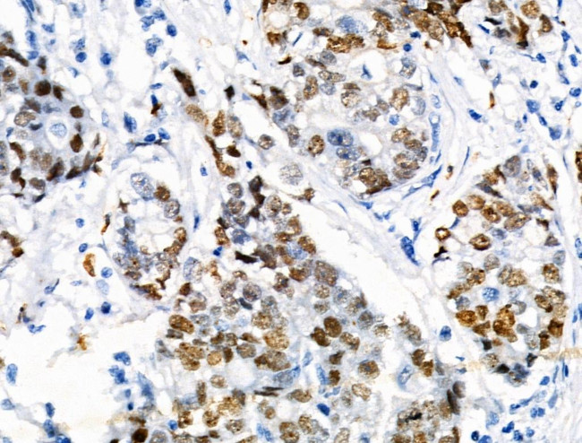 Phospho-TPPP (Ser18) Antibody in Immunohistochemistry (Paraffin) (IHC (P))