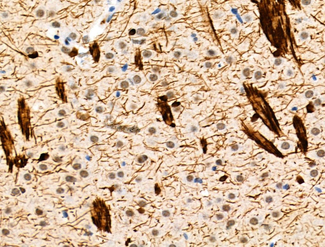 Phospho-TPPP (Ser18) Antibody in Immunohistochemistry (Paraffin) (IHC (P))