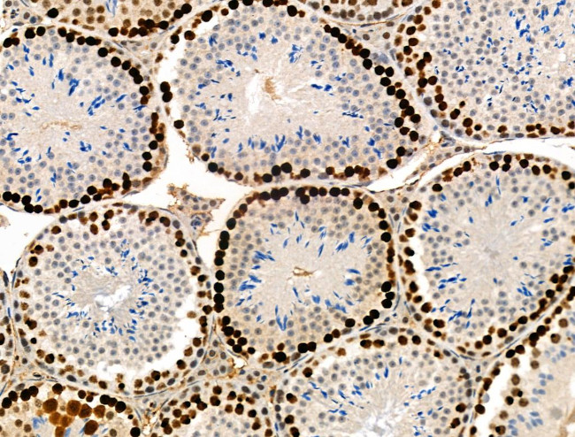 Phospho-TPPP (Ser18) Antibody in Immunohistochemistry (Paraffin) (IHC (P))