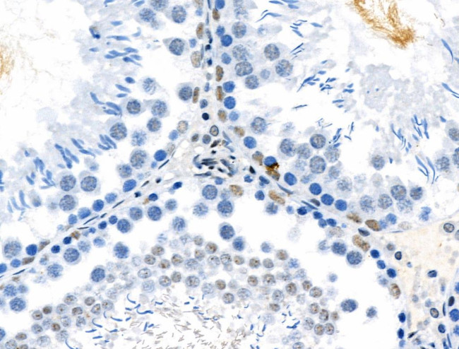 Phospho-TPPP (Ser18) Antibody in Immunohistochemistry (Paraffin) (IHC (P))