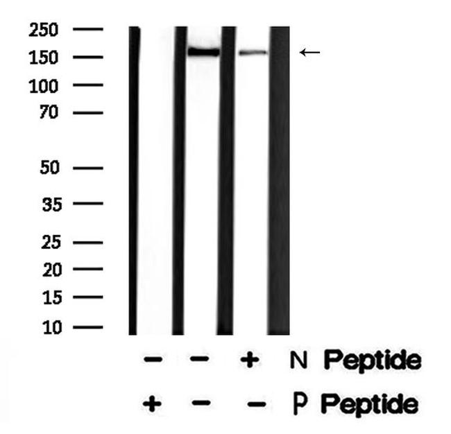 Phospho-LRP6 (Thr1479) Antibody in Western Blot (WB)