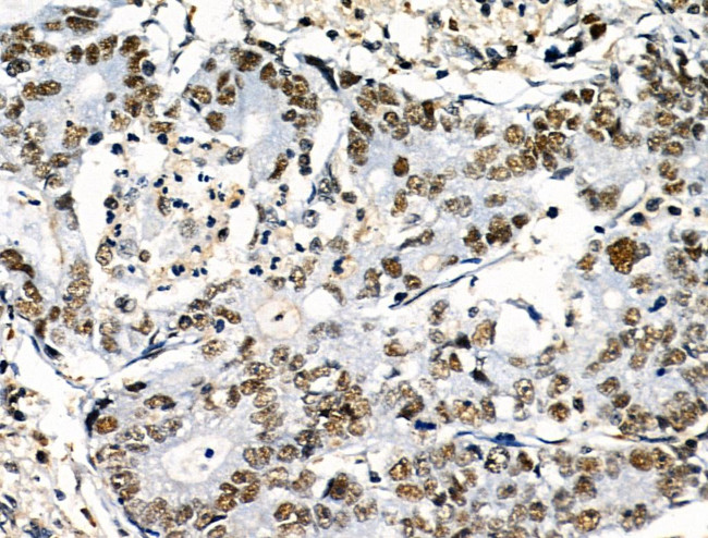 Phospho-POLR2A (Ser1616) Antibody in Immunohistochemistry (Paraffin) (IHC (P))