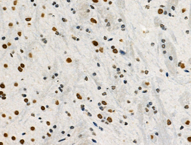 Phospho-POLR2A (Ser1616) Antibody in Immunohistochemistry (Paraffin) (IHC (P))