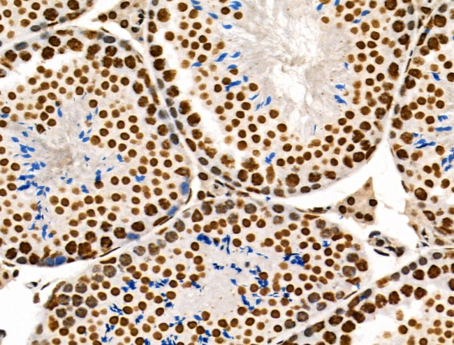 Phospho-POLR2A (Ser1616) Antibody in Immunohistochemistry (Paraffin) (IHC (P))