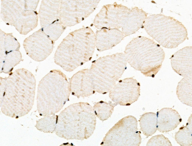 Phospho-POLR2A (Ser1616) Antibody in Immunohistochemistry (Paraffin) (IHC (P))