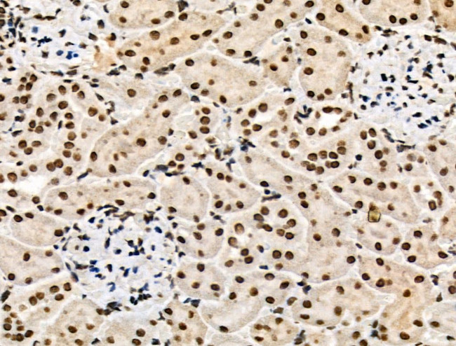 Phospho-POLR2A (Ser1616) Antibody in Immunohistochemistry (Paraffin) (IHC (P))