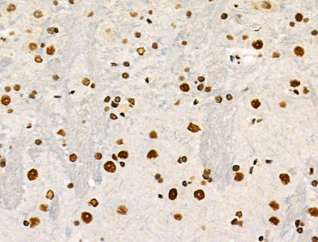 Phospho-POLR2A (Ser1616) Antibody in Immunohistochemistry (Paraffin) (IHC (P))