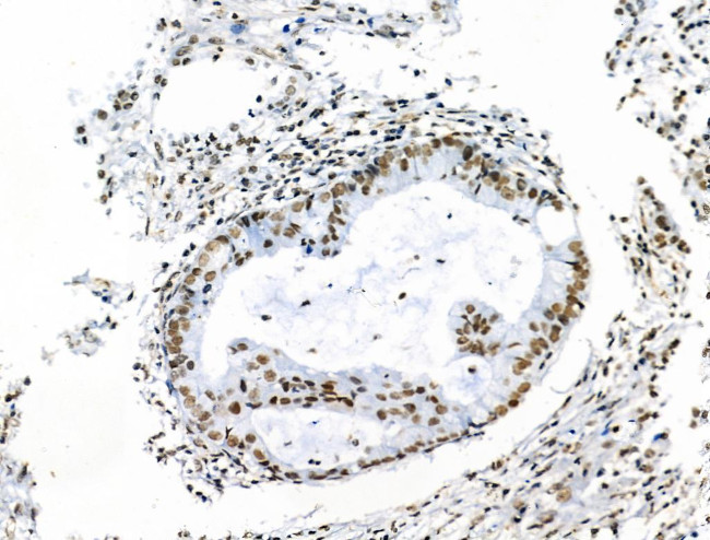 Phospho-POLR2A (Ser1616) Antibody in Immunohistochemistry (Paraffin) (IHC (P))