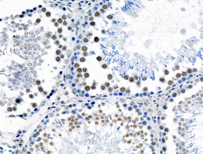 Phospho-POLR2A (Ser1616) Antibody in Immunohistochemistry (Paraffin) (IHC (P))