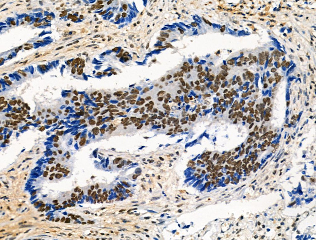 Phospho-POLR2A (Ser1616) Antibody in Immunohistochemistry (Paraffin) (IHC (P))