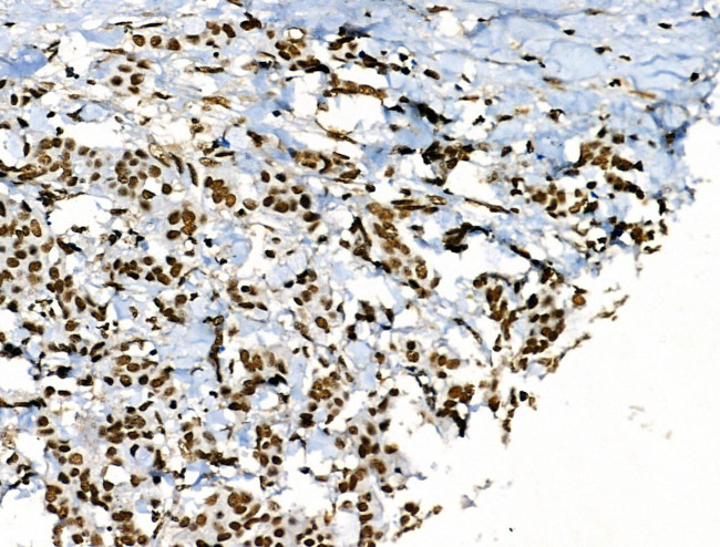 Phospho-POLR2A (Ser1616) Antibody in Immunohistochemistry (Paraffin) (IHC (P))